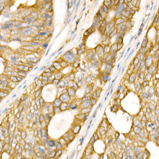 GSK-3Alpha/Beta Rabbit Polyclonal Antibody