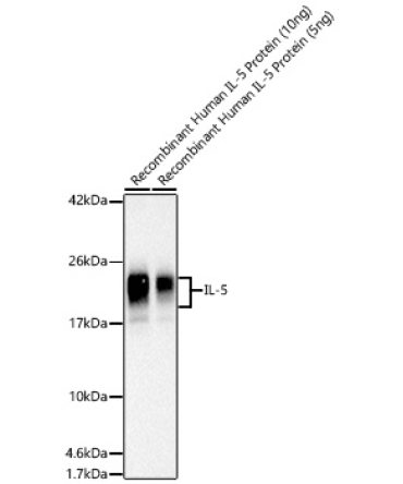 Human IL-5 Rabbit Polyclonal Antibody