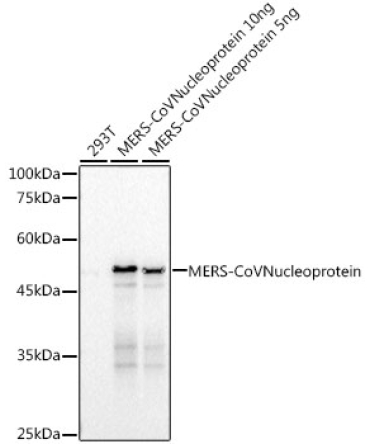 MERS-CoV Nucleoprotein Rabbit Monoclonal Antibody