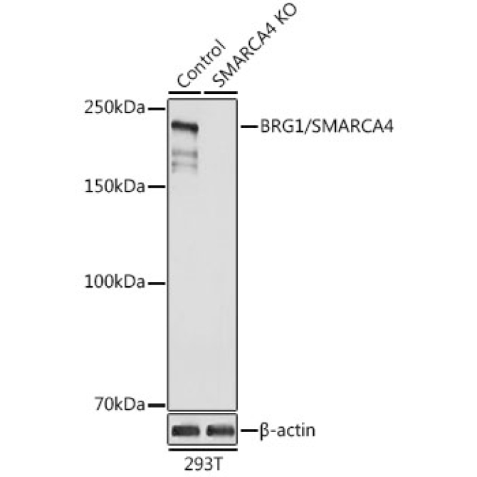 BRG1/SMARCA4 Rabbit Polyclonal Antibody [KO Validated]