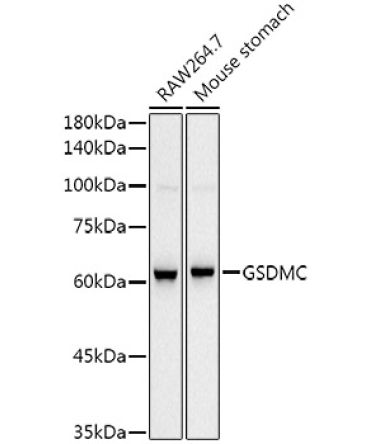 GSDMC Rabbit Monoclonal Antibody