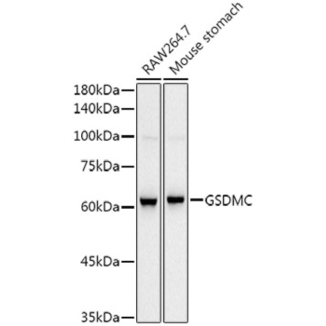 GSDMC Rabbit Monoclonal Antibody
