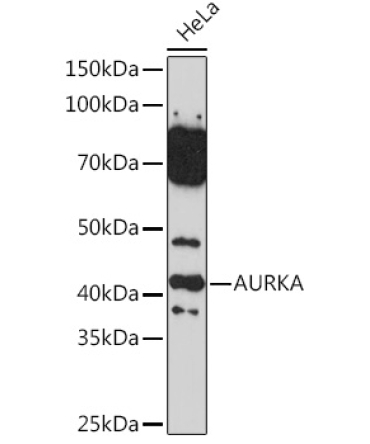 AURKA Rabbit Polyclonal Antibody