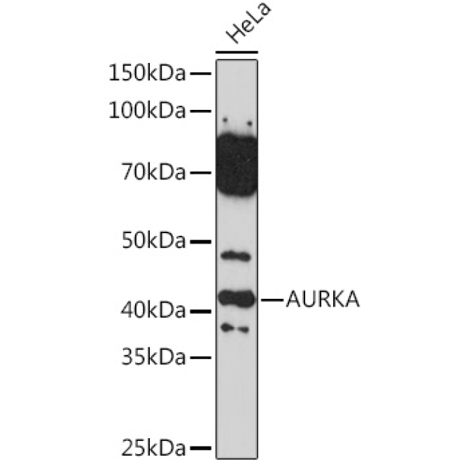 AURKA Rabbit Polyclonal Antibody