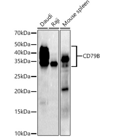CD79B Rabbit Monoclonal Antibody