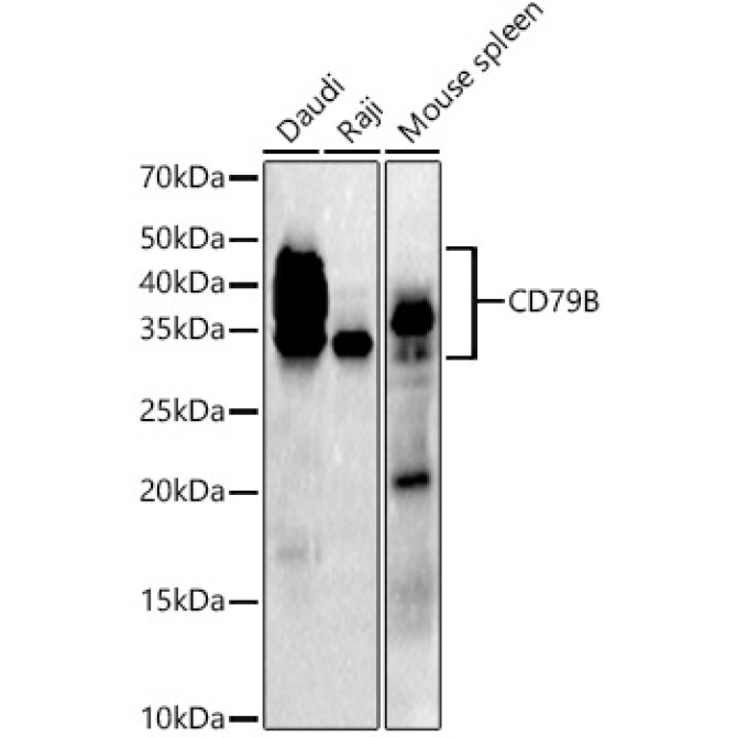 CD79B Rabbit Monoclonal Antibody