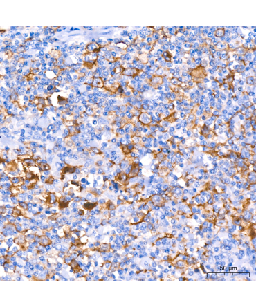 CD30 Rabbit Monoclonal Antibody