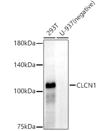 CLCN1 Rabbit Monoclonal Antibody