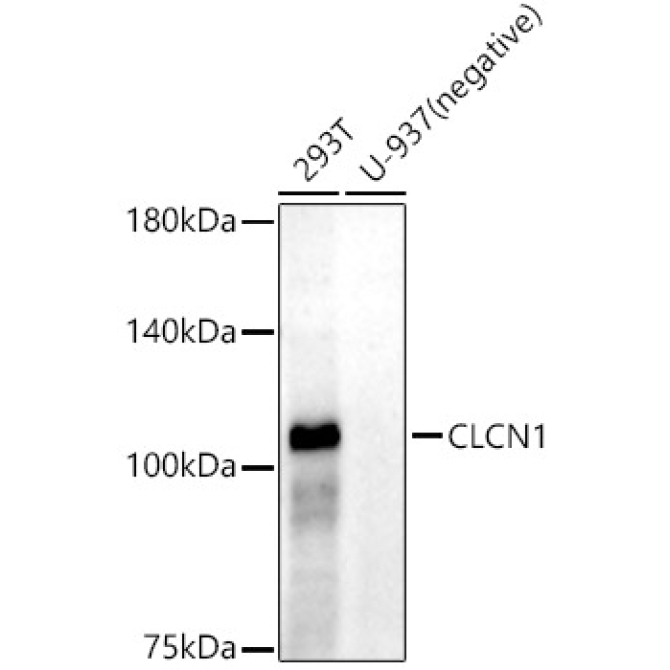 CLCN1 Rabbit Monoclonal Antibody