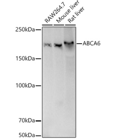 ABCA6 Rabbit Polyclonal Antibody [KD Validated]
