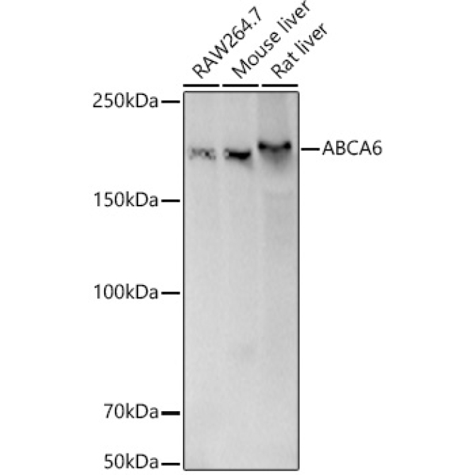 ABCA6 Rabbit Polyclonal Antibody [KD Validated]