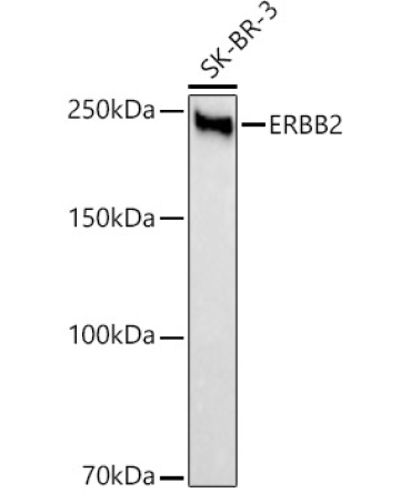 HER2/ErbB2 Rabbit Monoclonal Antibody