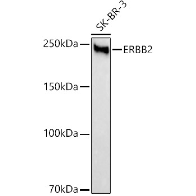 HER2/ErbB2 Rabbit Monoclonal Antibody