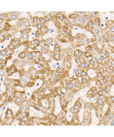 MT-ND6 Rabbit Monoclonal Antibody