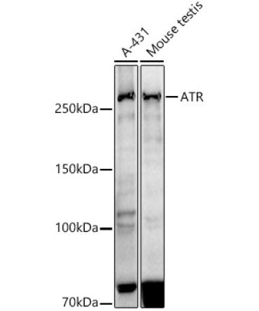 ATR Rabbit Monoclonal Antibody