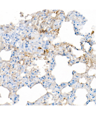 IL6 Rabbit Monoclonal Antibody
