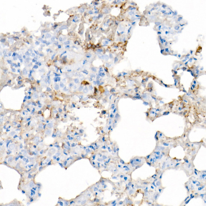 IL6 Rabbit Monoclonal Antibody