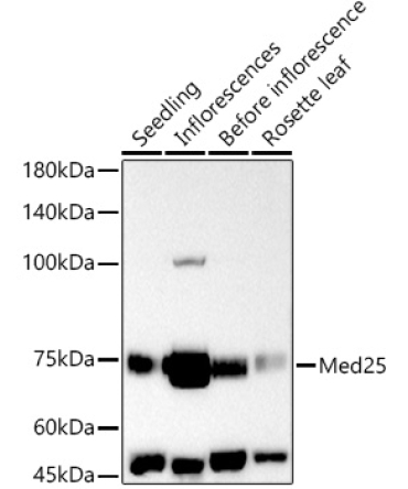 Med25 Rabbit Polyclonal Antibody