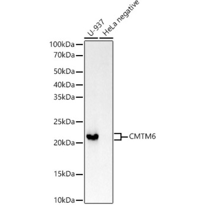 CMTM6 Rabbit Monoclonal Antibody