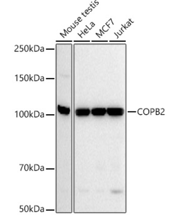 COPB2 Rabbit Monoclonal Antibody