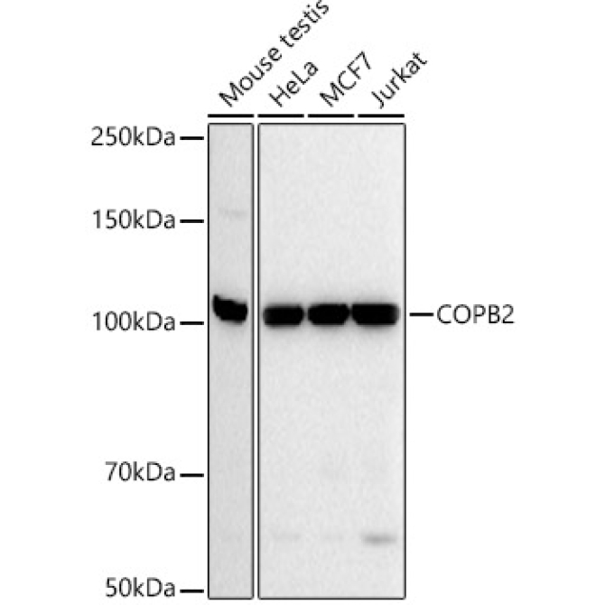 COPB2 Rabbit Monoclonal Antibody