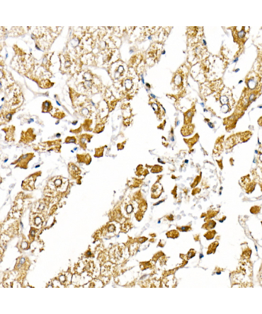 Caspase-1 Rabbit Polyclonal Antibody