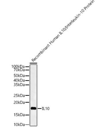 IL10 Rabbit Polyclonal Antibody