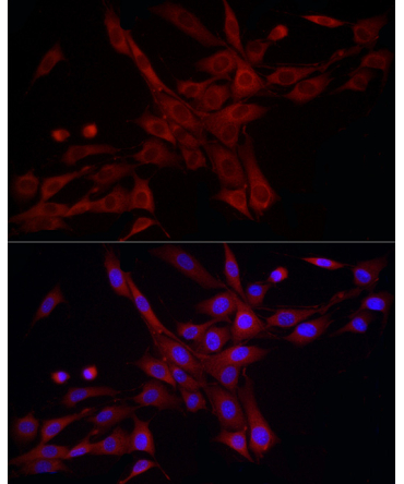 DNM1L Rabbit Polyclonal Antibody