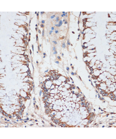 CDK4 Rabbit Polyclonal Antibody [KO Validated]