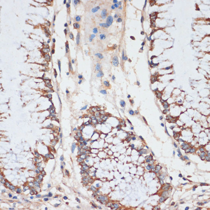 CDK4 Rabbit Polyclonal Antibody [KO Validated]