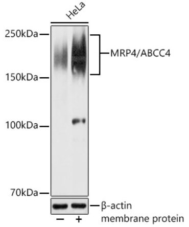 MRP4/ABCC4 Rabbit Polyclonal Antibody