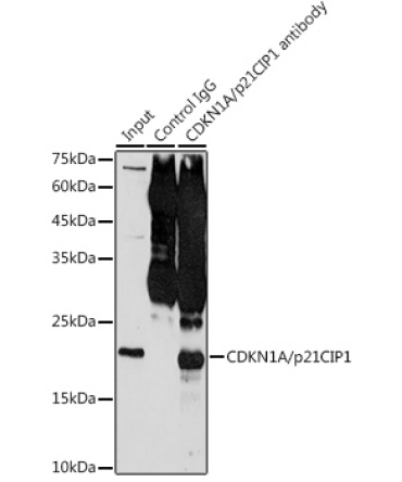 CDKN1A/p21CIP1 Rabbit Polyclonal Antibody
