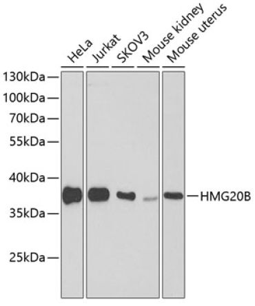 HMG20B Rabbit Polyclonal Antibody