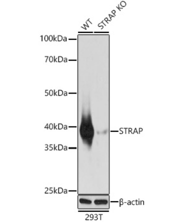 STRAP Rabbit Polyclonal Antibody [KO Validated]