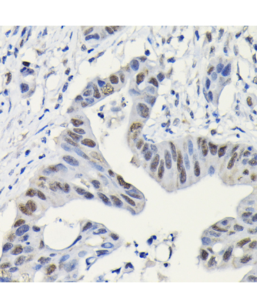 PARP1 Rabbit Polyclonal Antibody [KO Validated]