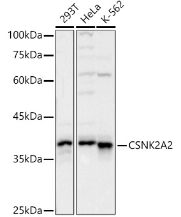 CSNK2A2 Rabbit Polyclonal Antibody