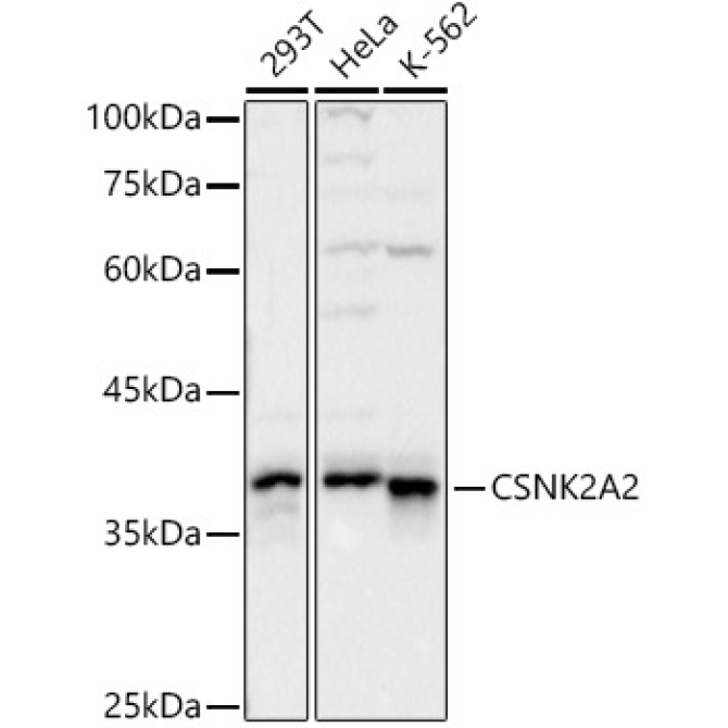 CSNK2A2 Rabbit Polyclonal Antibody