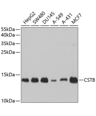 CSTB Rabbit Polyclonal Antibody