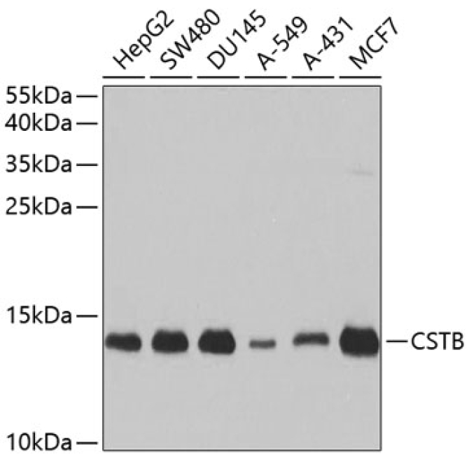 CSTB Rabbit Polyclonal Antibody