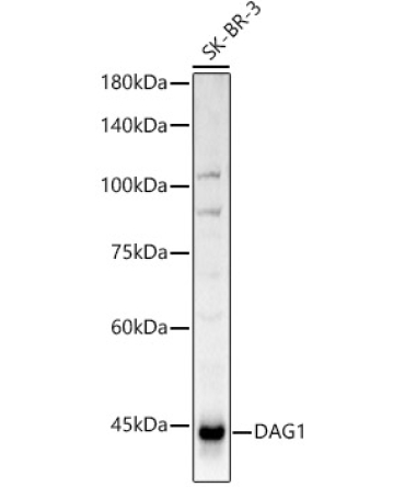 DAG1 Rabbit Polyclonal Antibody
