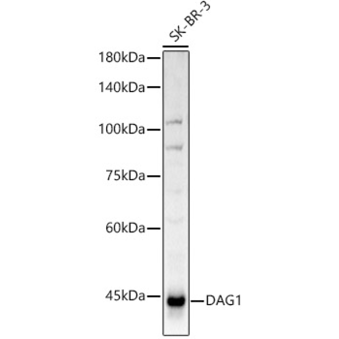 DAG1 Rabbit Polyclonal Antibody