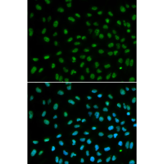 DDB2 Rabbit Polyclonal Antibody
