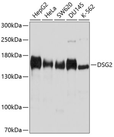 DSG2 Rabbit Polyclonal Antibody