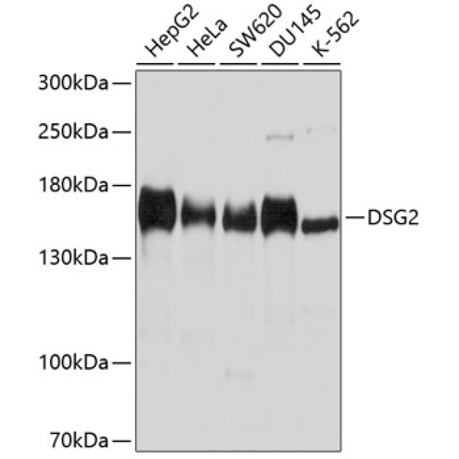 DSG2 Rabbit Polyclonal Antibody