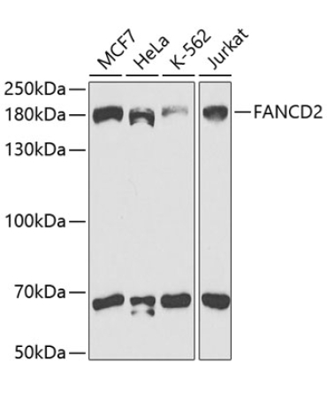 FANCD2 Rabbit Polyclonal Antibody