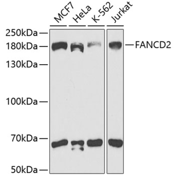 FANCD2 Rabbit Polyclonal Antibody