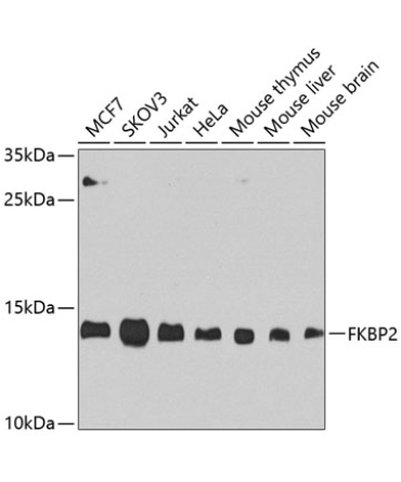 FKBP2 Rabbit Polyclonal Antibody