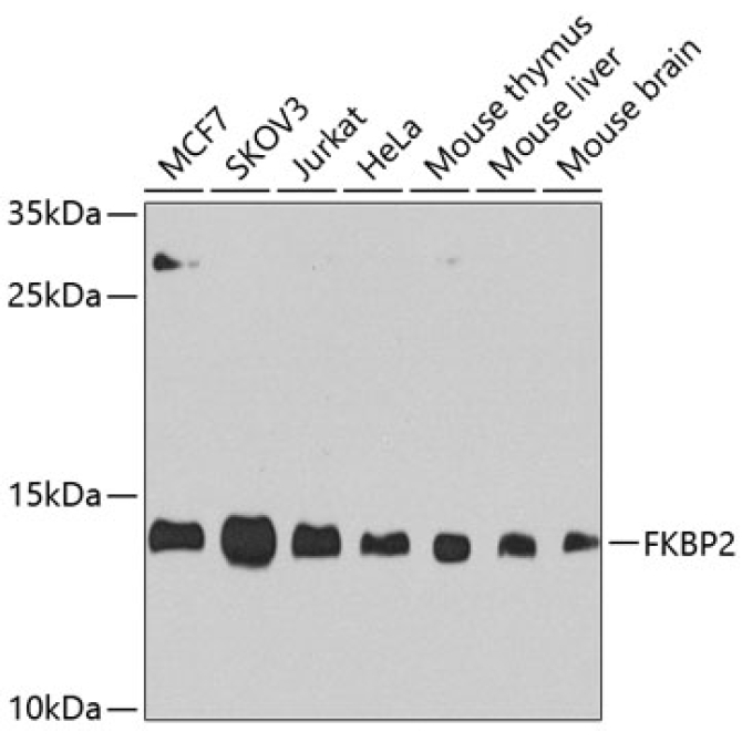 FKBP2 Rabbit Polyclonal Antibody