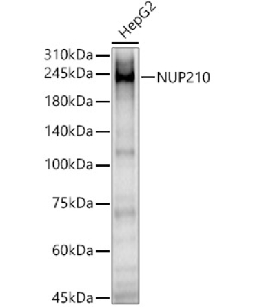NUP210 Rabbit Polyclonal Antibody