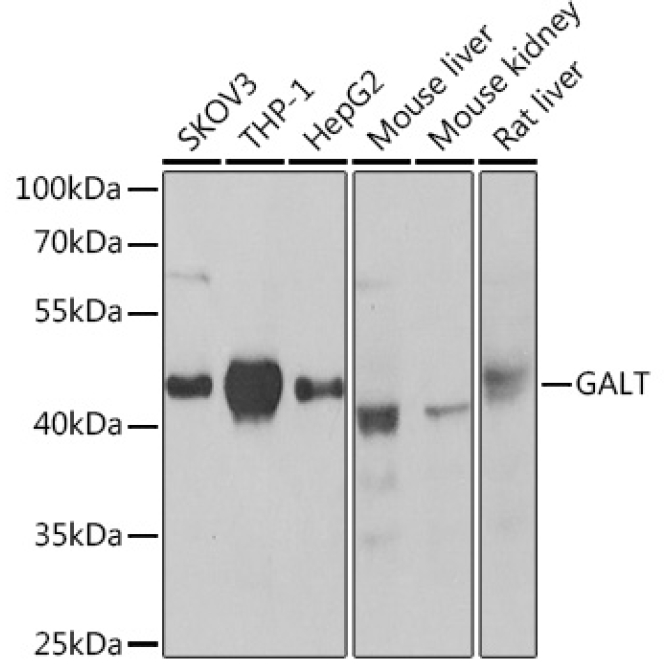 GALT Rabbit Polyclonal Antibody